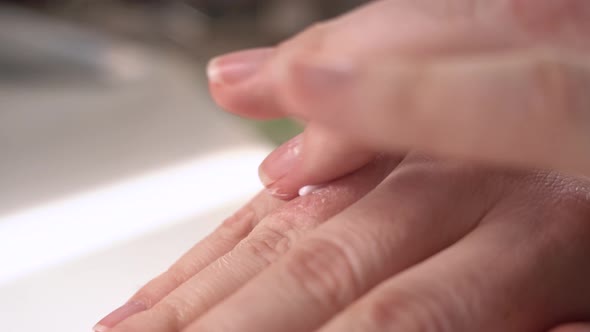 Girl or Woman Smears Eczema on Her Hands with Special Healing Ointment. Red Swollen Fingers Require