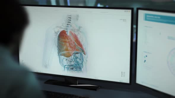 Researching X-Rayed Human Body In Medical Software At Scientific Laboratory alt