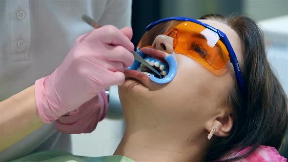 Dentist Prepares Patient For Teeth Whitening Procedure