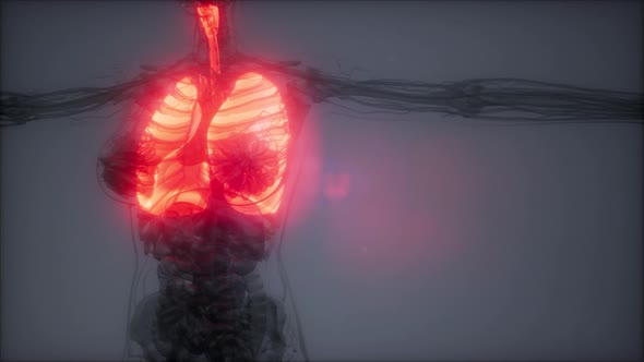 Human Lungs Radiology Exam alt