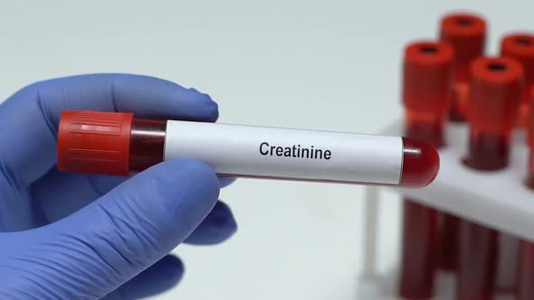 Creatinine, Doctor Holding Blood Sample in Tube Close-Up, Health Check-Up