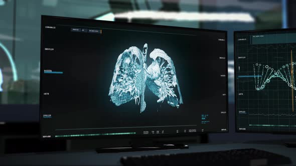 Examination Of Cancer Disease Using Innovative Medical X-Ray Scanner Interface alt