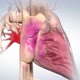 Filling the chamber of the heart with oxygen - VideoHive Item for Sale