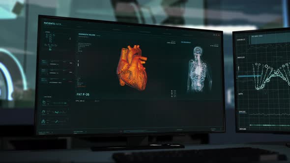 Modern medical examination system has detected Cardiac Ischemia disease alt