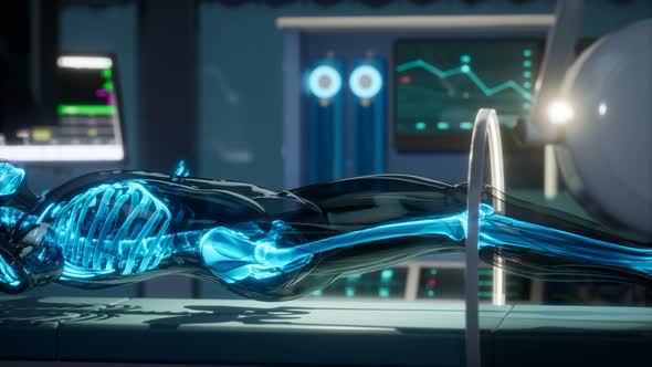 Human Skeleton Bones Scan Exam in Lab alt