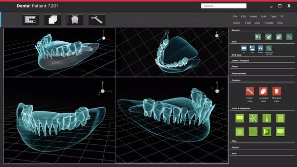 Human Xray Tooth and Scan Software Interface