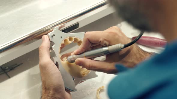 Crop orthodontist carving dental impression