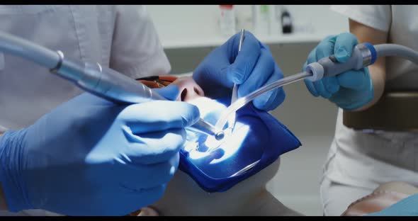 A Woman Patient in Protective Glasses with a Spreader Over Her Mouth