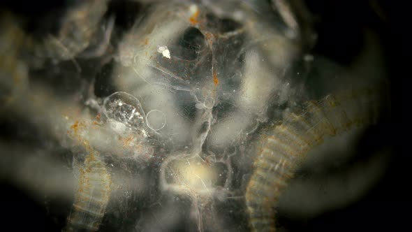 Larva Ctenophora Beroe Ovata with Cilia Under a Microscope. of the Beroidae Family