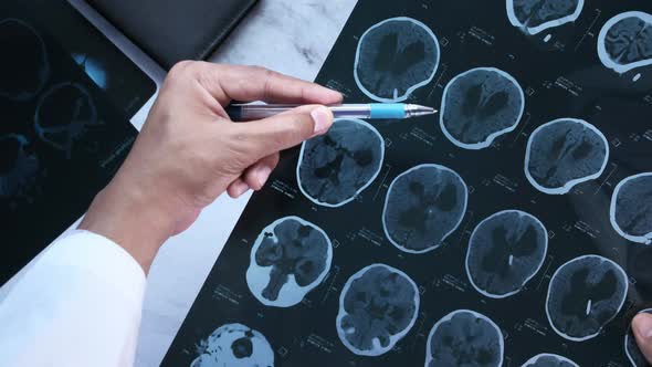 Male Doctor Hold i Analyzing Xray Photography Closeup