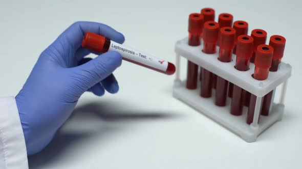 Positive Leptospirosis Test, Doctor Showing Blood Sample in Tube, Lab Research