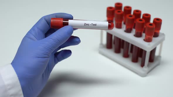 Zinc Test, Doctor Showing Blood Sample in Tube, Lab Research, Health Checkup