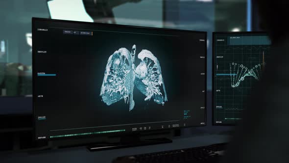 Analysis Of Human Organs Health In Modern X-ray Medical Computer Interface alt