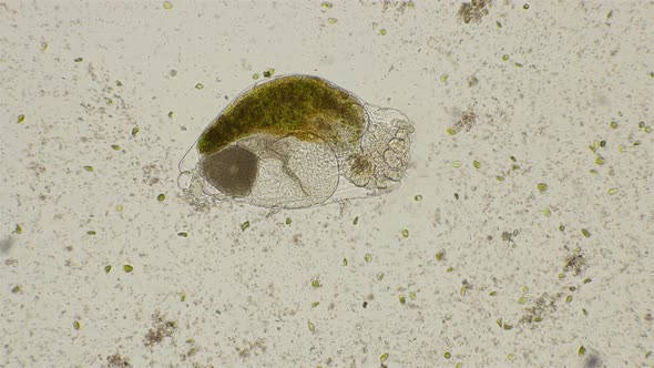 Rotifer Filters Water, and Around It I Swim the Alga Dunaliella Salina, Under a Microscope