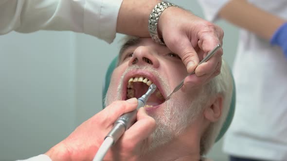 Dentist Polishing Teeth.