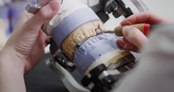 A female dentist technologist holds a mock-up of a jaw in her hands. Making dentures