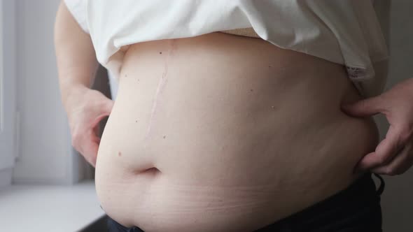 Mature Woman Strokes and Squeezes Fat Belly Near Windowsill