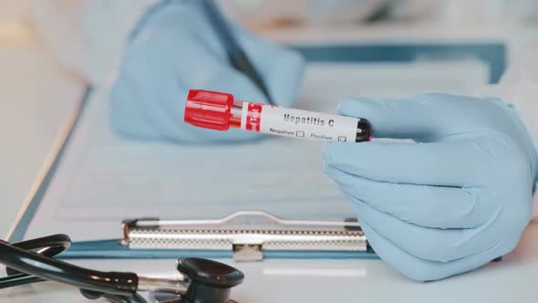 The Doctor Holds Hand Blood Sample Positive with Hepatitis C Virus