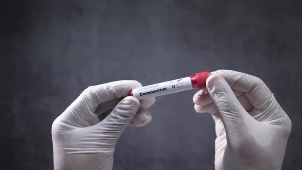  Hand Holding Corona Virus Blood Test Tube Isolated on Black 
