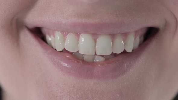 Close Up of Beautiful Woman Teeth with Smiling