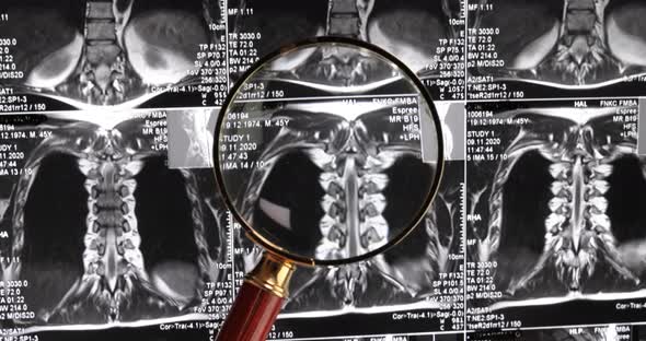 MRI Lumbar Spine Background Magnetic Resonance Tomography