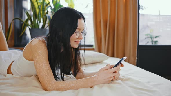 Close Up of Young Woman with Uneven Pigmentation Lying on Bed and Chatting on Smartphone Slow Motion