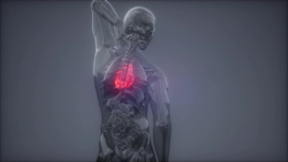 Human Heart Radiology Exam alt