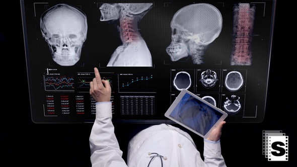 Doctor Looking Xray Data Monitor