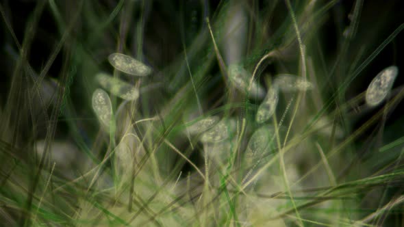 Infusorium Paramcium Under a Microscope