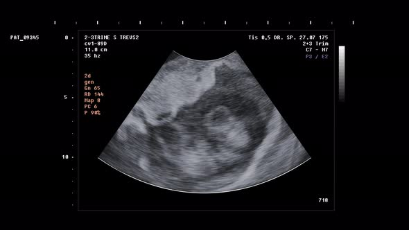 Diagnostic scanner identifies twins in womans body after examination procedure