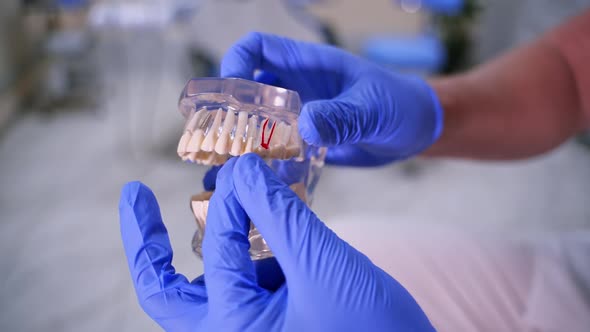 Jaw model in dentist's hands. Dental implant laboratory.