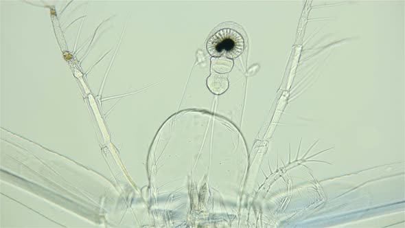 Zooplankton Under a Microscope