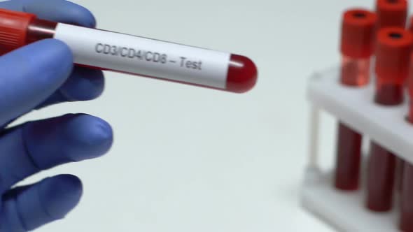 CD3 CD4 CD8-Test, Doctor Holding Blood Sample in Tube Close-Up, Health Check-Up