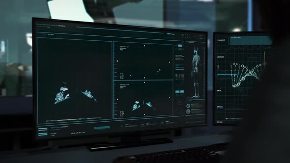 Medical X-ray Scan Of Patients Lungs Affected By Contagious Sars Virus Infection