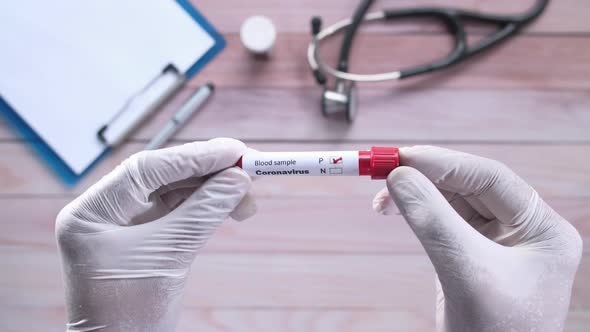 Laboratory Technician's Hand Holding Corona Virus Blood Test Tube 