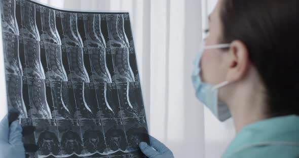 Female Doctor Examining Mri Film Scan Of Lumbar Spines Of A Patient With Chronic Back Pain