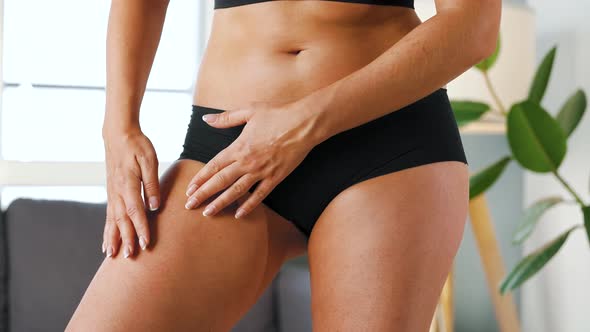 Woman Compressing the Skin on Her Legs Checking for Cellulite and Excess Subcutaneous Fat