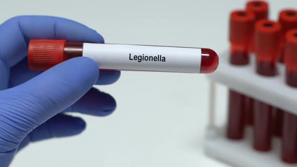 Legionella, Doctor Holding Blood Sample in Tube Close-Up, Health Check-Up