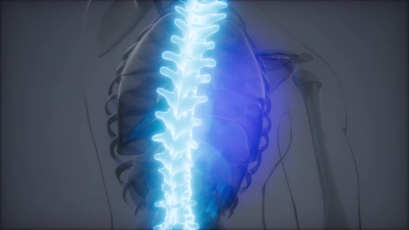 Backache in Back Bones alt