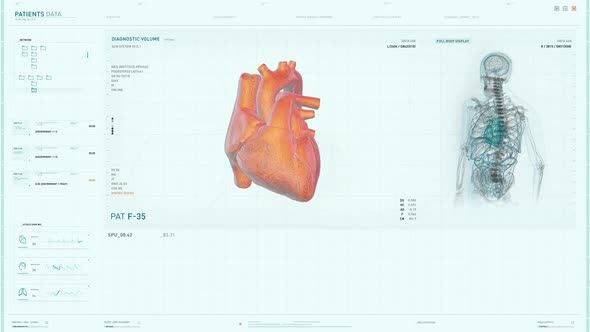 Health Care Research System Used To Diagnose Cardiac Ischemia In Patients Heart alt