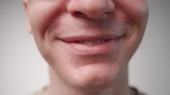 Man Smiling at Camera Showing His Crooked Teeth