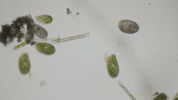 Paramecium Ciliates Under The Microscope