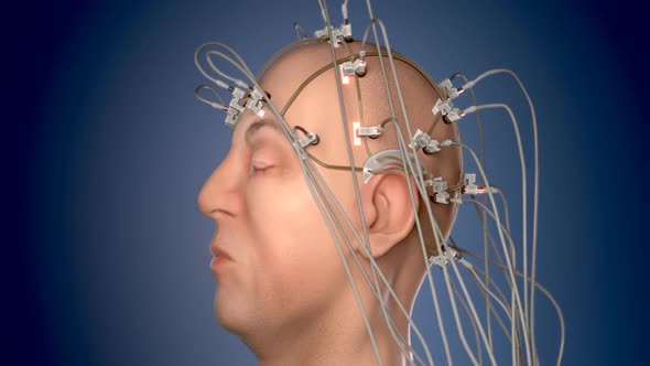 Electroencephalography machine analyzing activity of a human brain. Closeup. HD