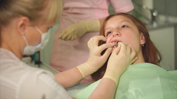 Process of Making Dental Filling
