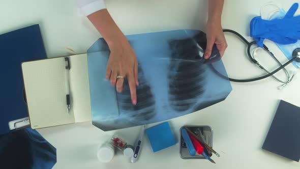Woman Doctor Looking at Lungs Xrays Top View