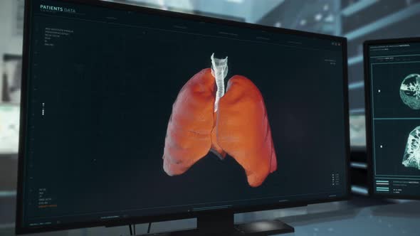 Medical Diagnosis System Checks Organ For Illness And Discovers Cancer alt