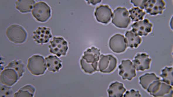 Blood Under A Microscope. Conditionally Pathogenic Bacteria In Blood Plasma