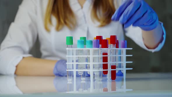 Scientist holding test tube. Technician of health with blood tubes in the clinical lab for analytica