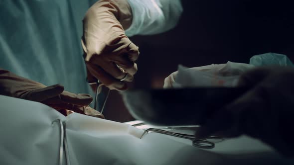 Surgeon Hands Using Clamp Operating Room Closeup