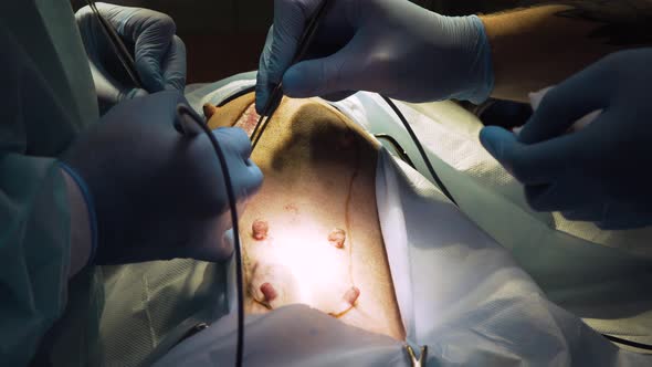 Surgical Operation of a Dog in a Veterinary Clinic